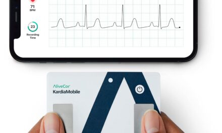 KardiaMobile Card Personal EKG Monitor Review